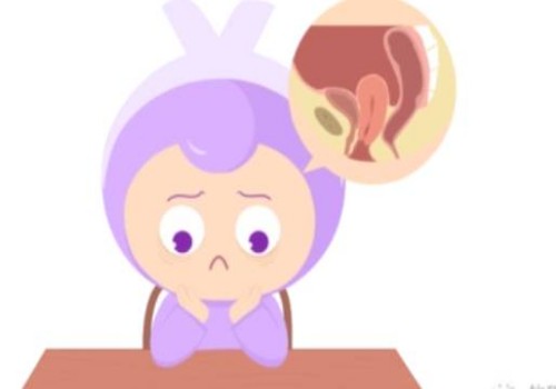 孕期假性阵痛是什么原因,预防假性阵痛的方法